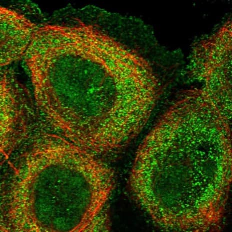 Anti-KMT2D / MLL2 antibody(AB224156)