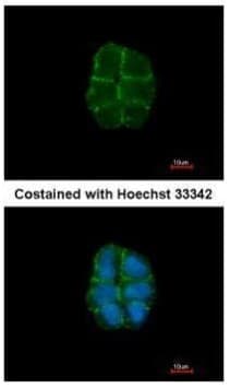 Anti-Desmoglein 2/DSG2 antibody(AB96761)
