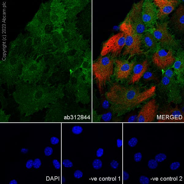 Anti-Kir4.1/KCNJ10 antibody [EPR27251-74](AB312844)