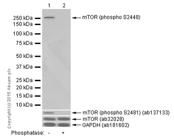 Anti-mTOR (phospho S2448) antibody [EPR426(2)](AB109268)