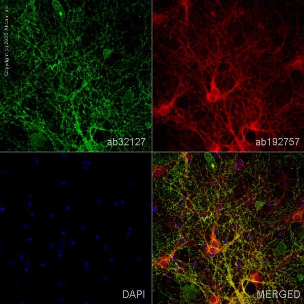 Anti-Synaptophysin antibody [YE269](ab32127)