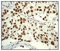 Anti-Cdk9 antibody [EPR3119Y](AB76320)