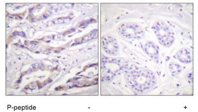 S6k1 Phospho T389 T412 Antibody Ab60948  Immunohistochemistry Formalin Pfa Fixed Paraffin Embedded Sections Img92185