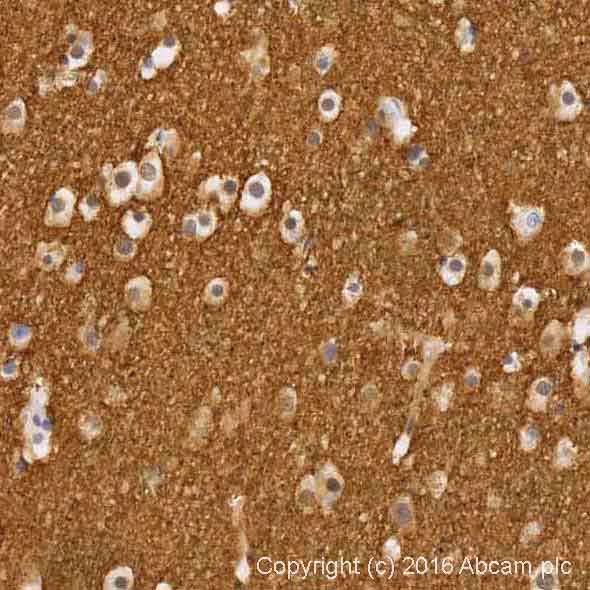 Alpha Synuclein Antibody Mjfr1 Bsa And Azide Free Ab209420 Immunohistochemistry Formalin Pfa Fixed Paraffin Embe Qe2SGmuKlO