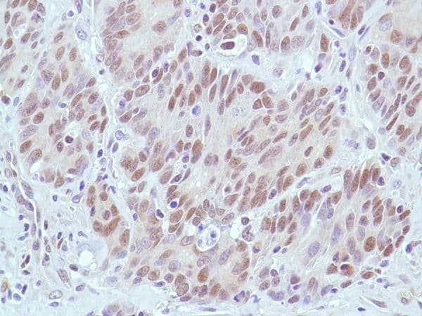 Anti-MSH2 antibody [SP46](AB231437)