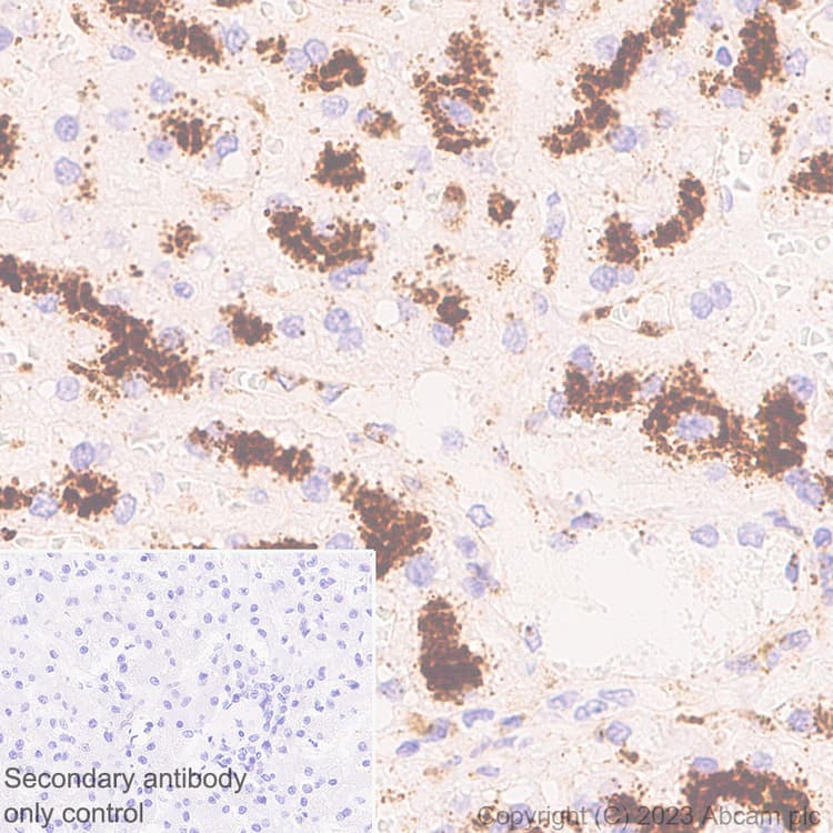 Limpii Antibody Epr26243 125 Ab314217  Immunohistochemistry Formalin Pfa Fixed Paraffin Embedded Sections Img421585