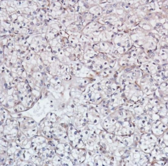 Anti-Smad4 antibody [SP306] - C-terminal, prediluted(AB228205)