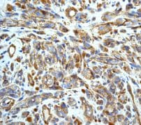 Anti-CD146 antibody [EPR3208](ab75769)