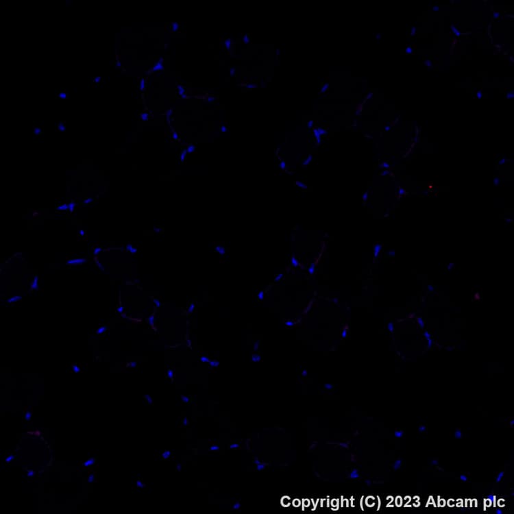 Alexa Fluor 555 Granzyme B Antibody Epr22645 206 Ab308602  Immunohistochemistry Formalin Pfa Fixed Paraffin Embedded Sections Img409019