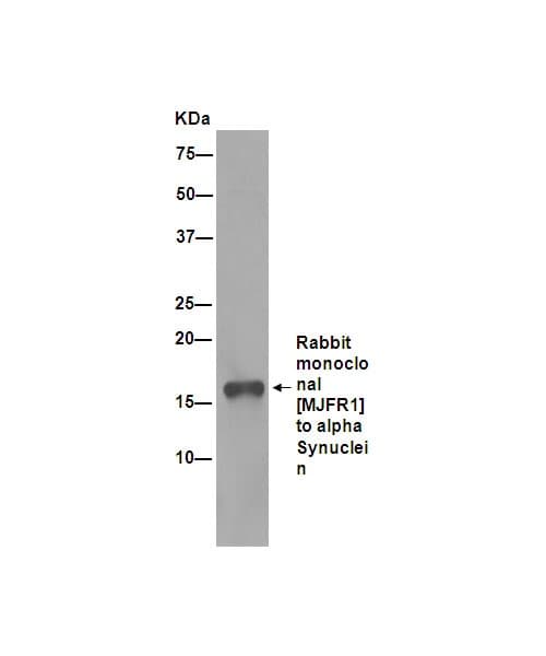 Anti-Alpha-synuclein antibody [MJFR1](AB138501)