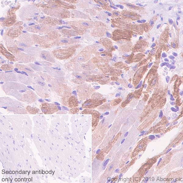 Anti-Slow Skeletal Myosin Heavy chain antibody [EPR22697-17](AB234431)
