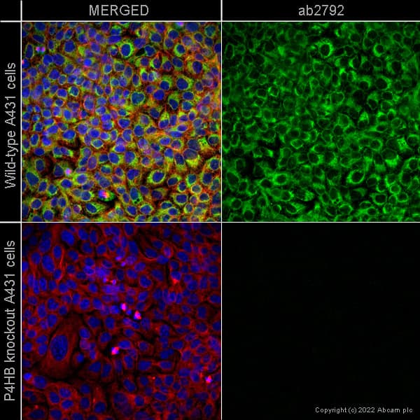 Anti-P4HB antibody [RL90](AB2792)