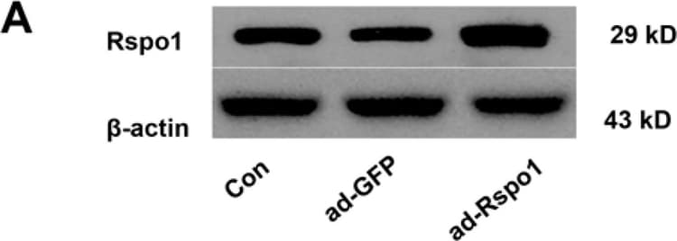 Anti-RSPO1 antibody(AB106556)