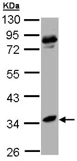 Anti-Liver Arginase antibody(AB96183)