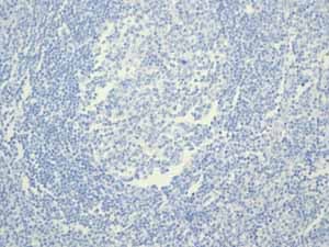 Anti-Estrogen Receptor alpha antibody [EPR4097](AB108398)