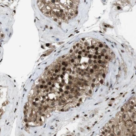 Orai3 Antibody Ab224095  Immunohistochemistry Formalin Pfa Fixed Paraffin Embedded Sections Img113408