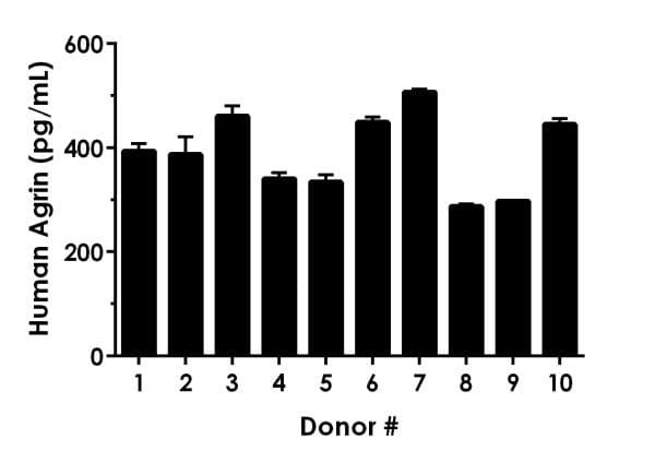 Human Agrin ELISA Kit(AB216945)