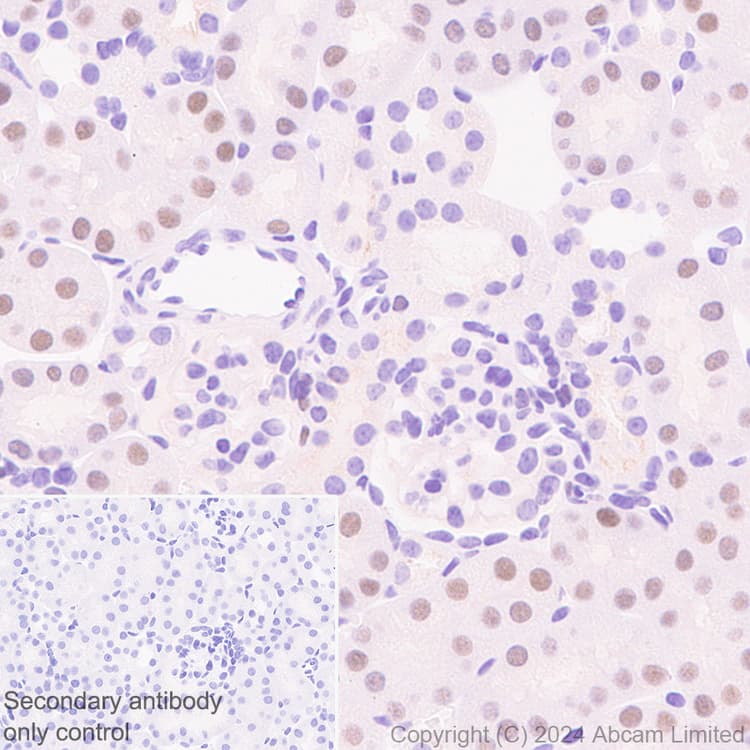 Anti-TOX antibody [EPR28108-10](ab322259)