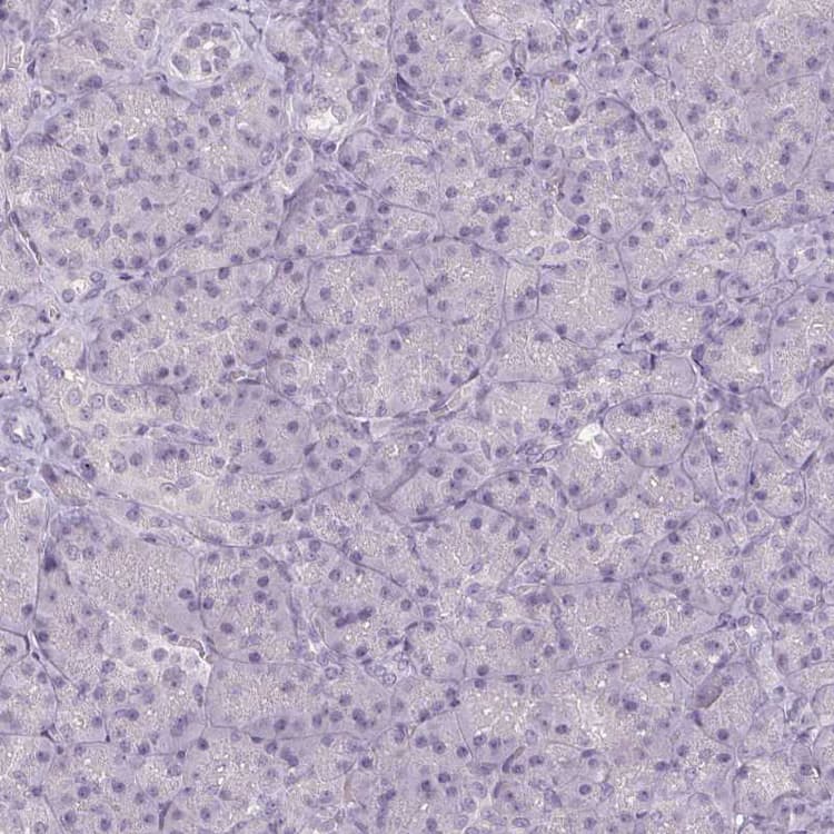 Anti-FAM168A antibody(AB254815)