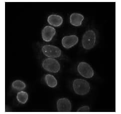 Anti-Lamin B Receptor/LBR antibody(AB122919)