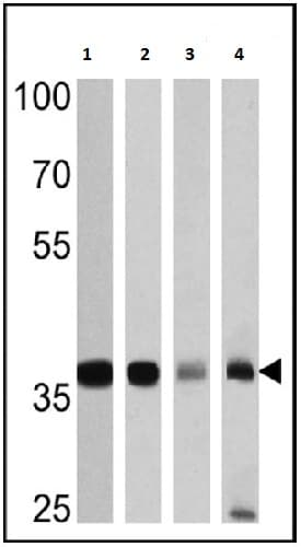 Anti-GAPDH antibody - Loading Control(AB22555)