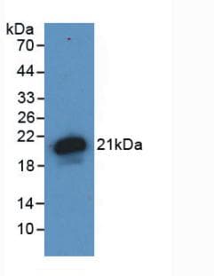 Hemojuvelin Antibody C6 Ab239495  Western Blot Img117265