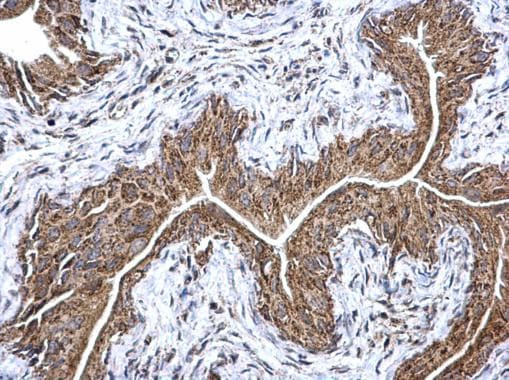 Etfa Antibody Ab153722  Immunohistochemistry Formalin Pfa Fixed Paraffin Embedded Sections Img56683