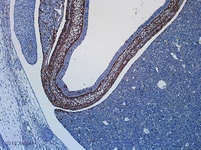 Anti-beta Galactosidase antibody(AB9361)