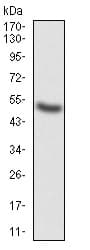 Anti-G-CSF antibody [7E4F7](AB204989)