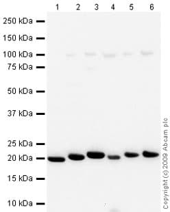 Anti-Ferritin Light Chain antibody(AB69090)