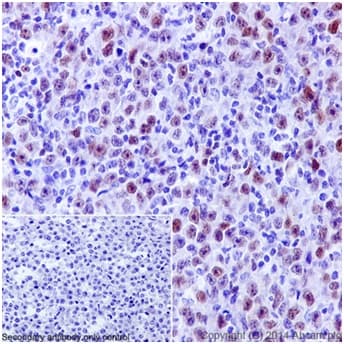 Anti-PRDM1/Blimp1 antibody [EPR16655] - BSA and Azide free(AB240344)
