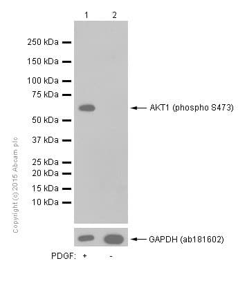 Anti-AKT1 (phospho S473) antibody [EP2109Y](AB81283)