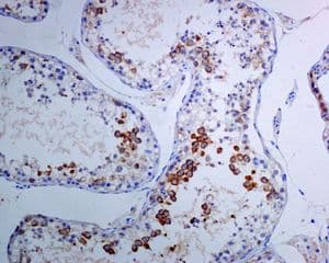 Tacc3 Antibody Epr7756 Bsa And Azide Free Ab224525  Immunohistochemistry Formalin Pfa Fixed Paraffin Embedded Sections Img117574
