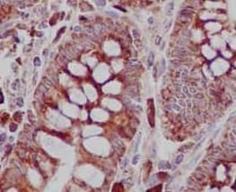 Anti-TREX1 antibody [EPR14985] - BSA and Azide free(AB236140)