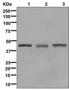 Anti-Glutamine Synthetase antibody [EPR13022(B)](AB176562)