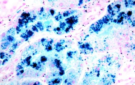 Iron Stain Kit (Prussian Blue Stain)(AB150674)