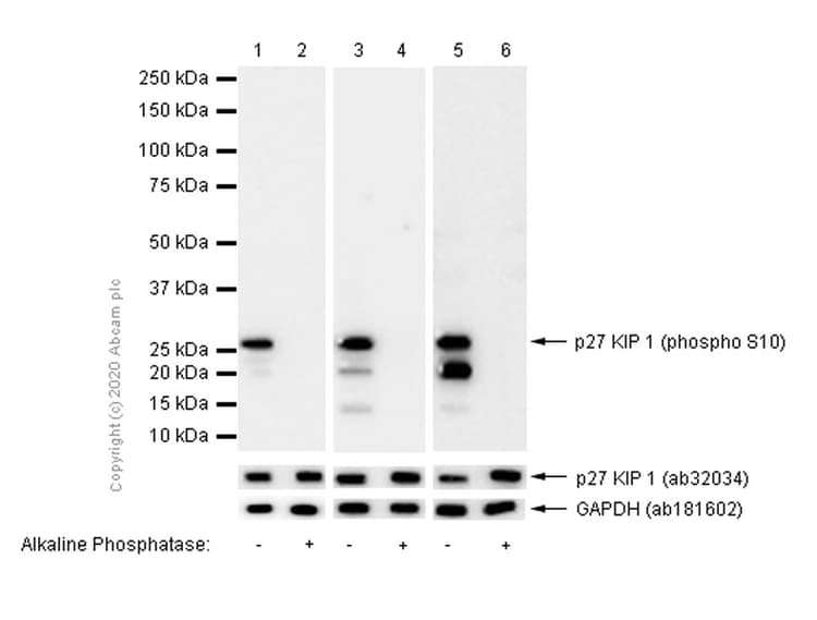 P27 Kip 1 Phospho S10 Antibody Ep2332y Ab62364  Western Blot Img30176