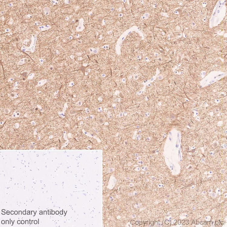 68kda Neurofilament Nf L C Term Antibody Epr28784 63 Bsa And Azide Free Ab315815  Immunohistochemistry Formalin Pfa Fixed Paraffin Embedded Sections Img425441