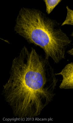 Donkey Anti-Rabbit IgG H&L (Alexa Fluor® 568) preadsorbed(AB175693)