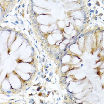 Elafin Esi Antibody Ab192345  Immunohistochemistry Formalin Pfa Fixed Paraffin Embedded Sections Img114441