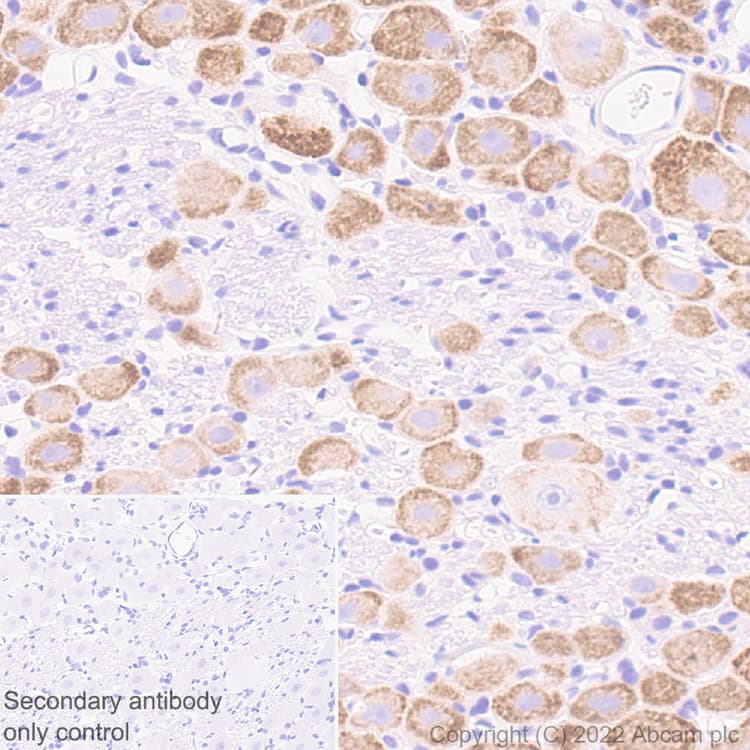 Anti-Nav1.8/SCN10A antibody [EPR25132-222](AB307817)