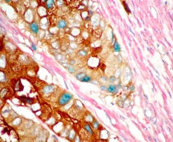 TripleStain IHC Kit: M&M&R on Human tissue (DAB, AP/Red & HRP/Green)(AB183286)