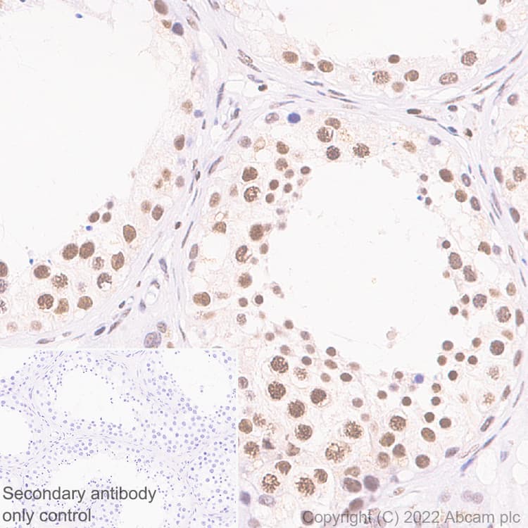 Hnrnp H Antibody Epr25302 12 Bsa And Azide Free Ab289999  Immunohistochemistry Formalin Pfa Fixed Paraffin Embedded Sections Img180861