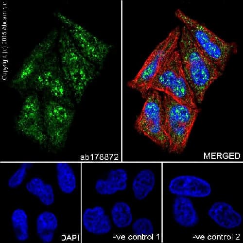 Anti-IKK gamma/NEMO antibody [EPR16629] - BSA and Azide free(AB230832)