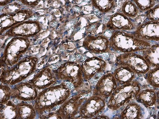 Anti-Hexokinase II antibody(AB227198)