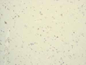 Anti-Lysozyme antibody [EPR2994(2)](AB108508)