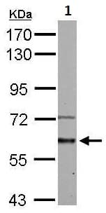 Activin Receptor Type Ia Antibody Ab262699  Western Blot Img84542