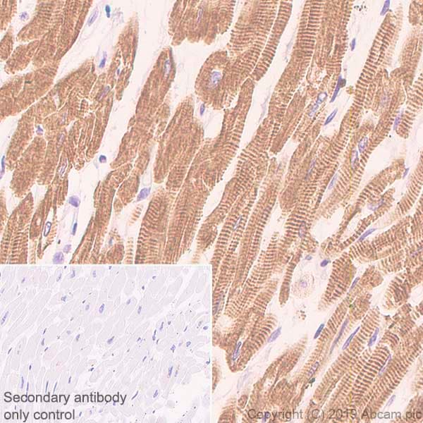 Anti-Slow Skeletal Myosin Heavy chain antibody [EPR22697-17](AB234431)