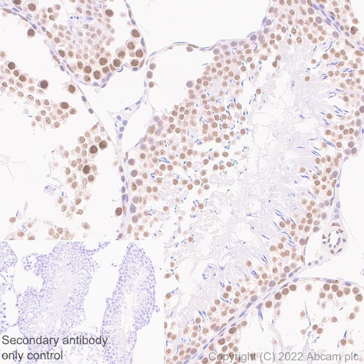Hnrnp H Antibody Epr25302 12 Bsa And Azide Free Ab289999  Immunohistochemistry Formalin Pfa Fixed Paraffin Embedded Sections Img181069