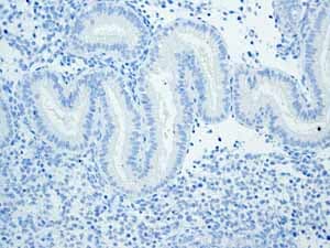 Anti-Trefoil Factor 3 antibody [EPR3974](AB108599)